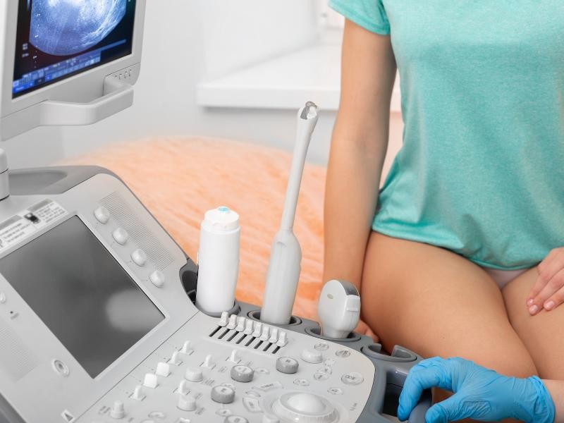 Ultrassom transvaginal em Mooca